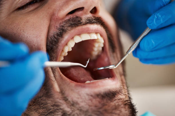 Best Emergency Root Canal Treatment in Russell, KS